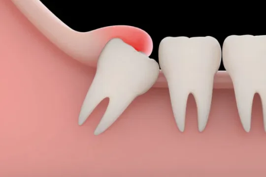 thumbnail-25