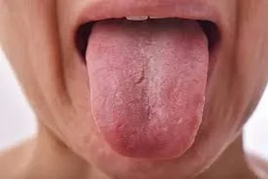 thumbnail-6